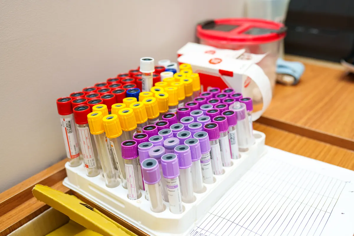 Tubos de coleta organizados na bancada do laboratório